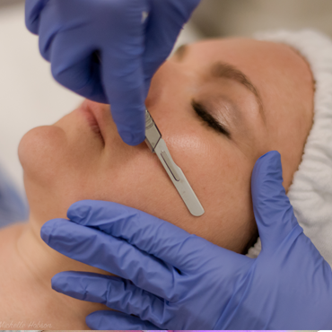 Dermaplaning facial treatment image