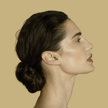 Profhilo skin treatment