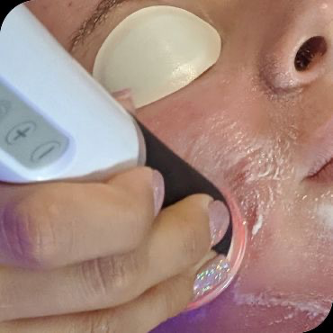 3D Hydro2 Facial Step 2