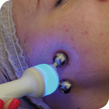 3D Hydro2 Facial Step 4
