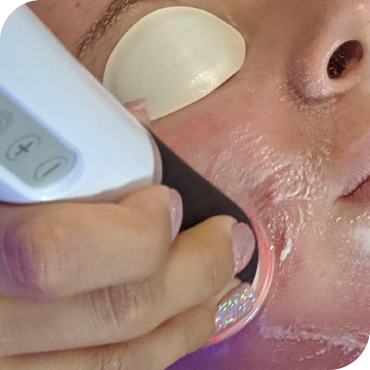 3D Hydro2 Facial Step 6