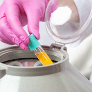 PRP Facial test tube