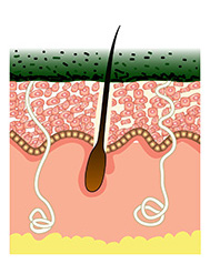 Step 2 DÉCAAR Algae Peel