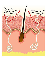 Step 5 DÉCAAR Algae Peel